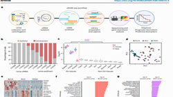 Urine cell-free RNA for bladder cancer detection and treatment response prediction
